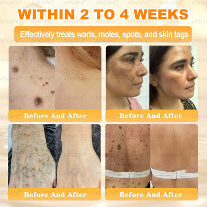 ⚡ You’ve just unlocked a secret 𝐀𝐏𝐊𝐀𝐏𝐊® deal! Grab 30% OFF your entire order — today only! Stocks are flying — claim yours before it’s gone! 🚀