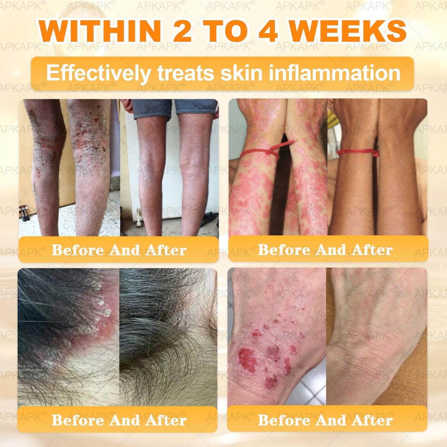 ⚡ You’ve just unlocked a secret 𝐀𝐏𝐊𝐀𝐏𝐊® deal! Grab 30% OFF your entire order — today only! Stocks are flying — claim yours before it’s gone! 🚀