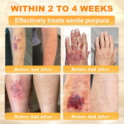 ⚡ You’ve just unlocked a secret 𝐀𝐏𝐊𝐀𝐏𝐊® deal! Grab 30% OFF your entire order — today only! Stocks are flying — claim yours before it’s gone! 🚀