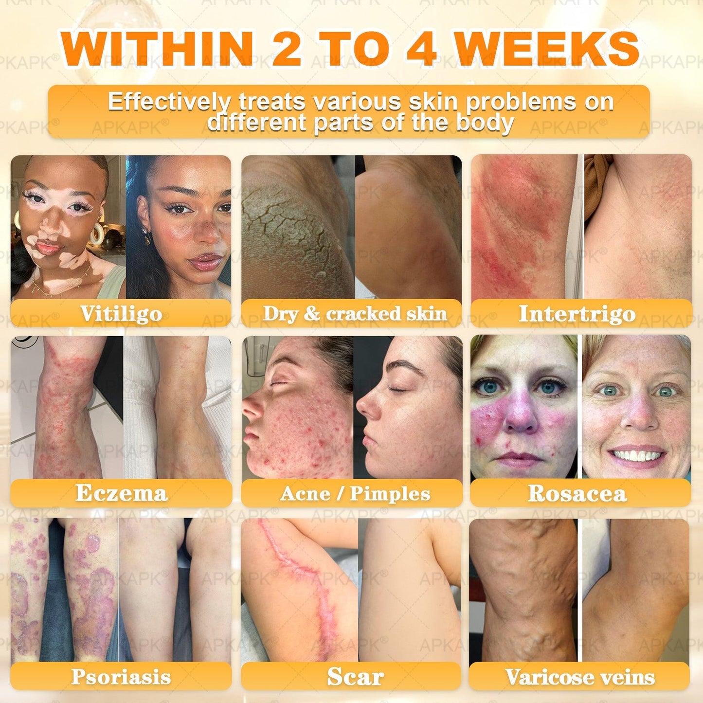 ⚡ You’ve just unlocked a secret 𝐀𝐏𝐊𝐀𝐏𝐊® deal! Grab 30% OFF your entire order — today only! Stocks are flying — claim yours before it’s gone! 🚀