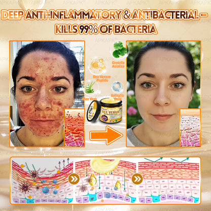 ⚡ You’ve just unlocked a secret 𝐀𝐏𝐊𝐀𝐏𝐊® deal! Grab 30% OFF your entire order — today only! Stocks are flying — claim yours before it’s gone! 🚀